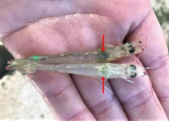 Điều trị bệnh EMS