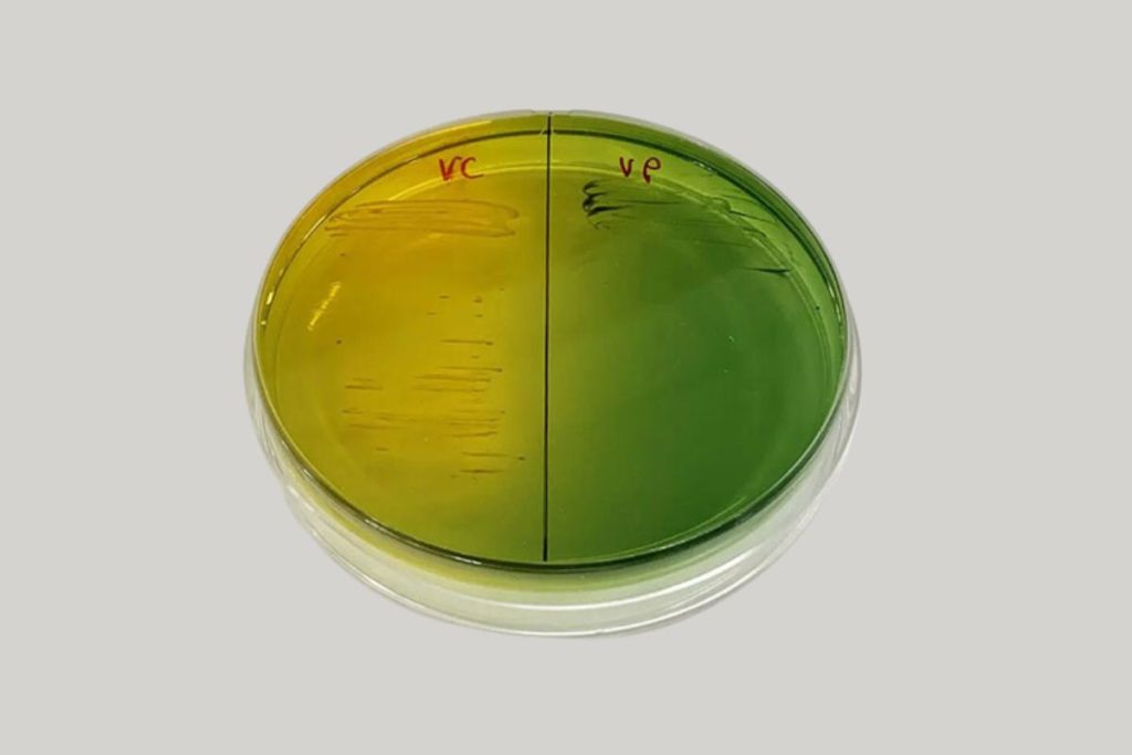 Phân biệt khuẩn lạc Vibrio trên đĩa thạch TCBS